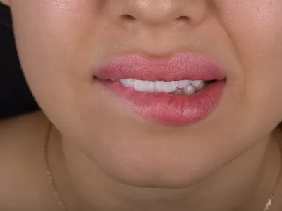 Dental Fotoğraf Çekimi - Görsel 2