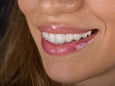 Dental Fotoğraf Çekimi - Görsel 3