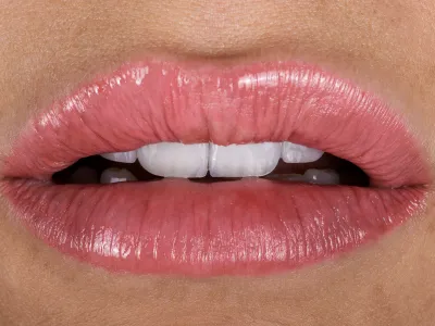 Dental Fotoğraf Çekimi - Görsel 8