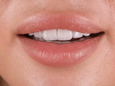 Dental Fotoğraf Çekimi - Görsel 10