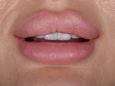 Dental Fotoğraf Çekimi - Görsel 11